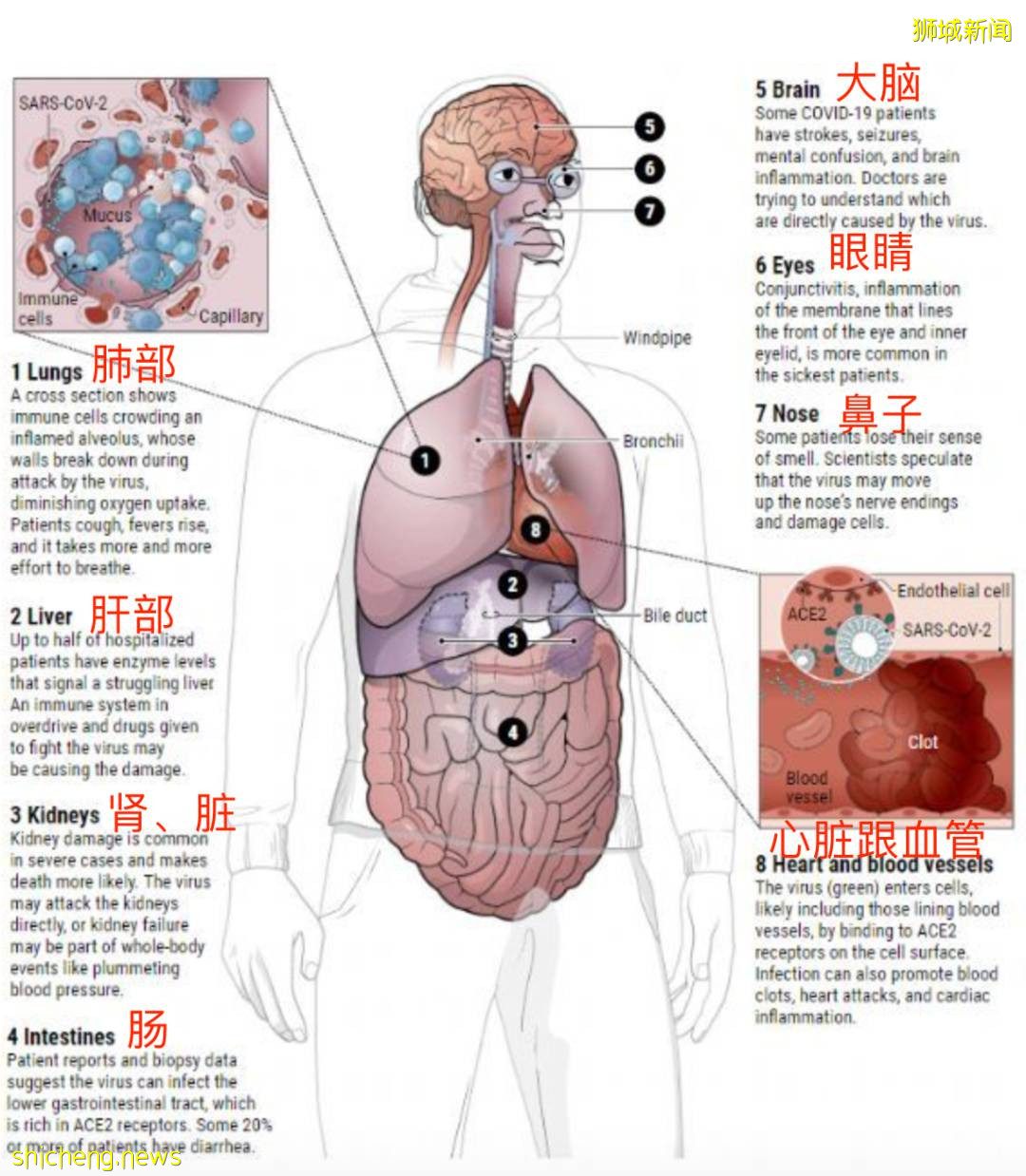 新冠长期后遗症竟有200多种!新加坡一起死亡病例被室友传染,确诊到死亡仅5天