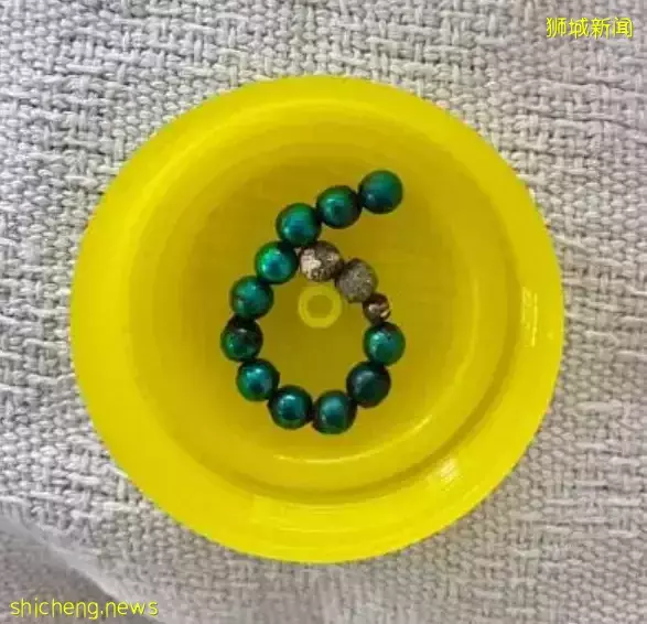 新加坡9歲娃因它切除兩節小腸！這些危險玩具你家可能也有