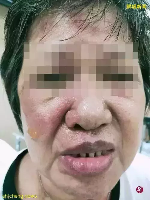 一人丢热汤,一人泼热粥,新加坡两火爆男分别烫伤摊贩