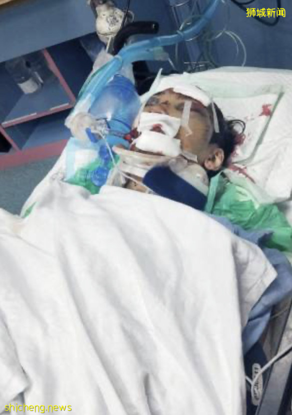 日做夜做爲妻小 送餐員疑雨天失控 飛墜溝渠昏迷 !