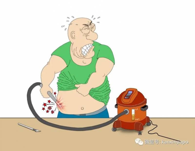 为了减肥去做抽脂手术而死，医生赔560万