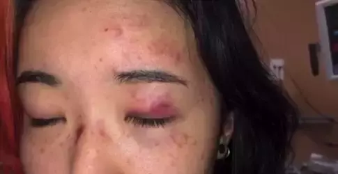 “滾出中國！” 她在深圳地鐵和老外互罵！以前華人被歧視，現輪到老外被怼