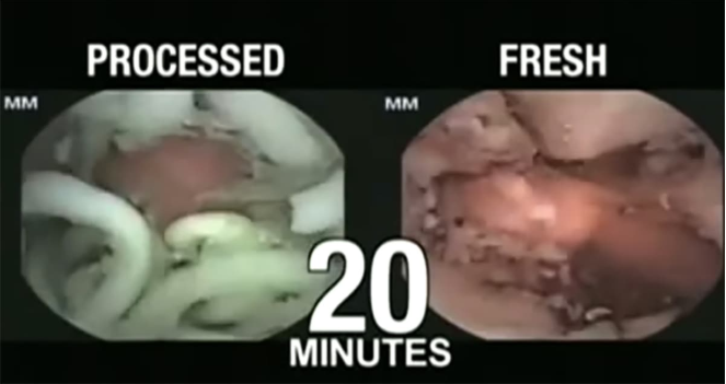 快熟面吃多致癌？台湾学生胃癌病逝的旧闻被翻炒疯传