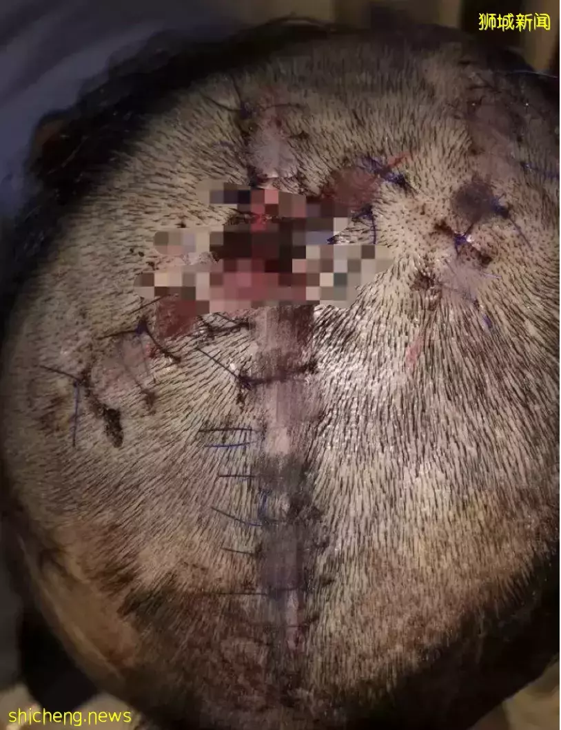 新加坡男子在克拉码头随机被砍!头顶两刀、满身是血,场面骇人