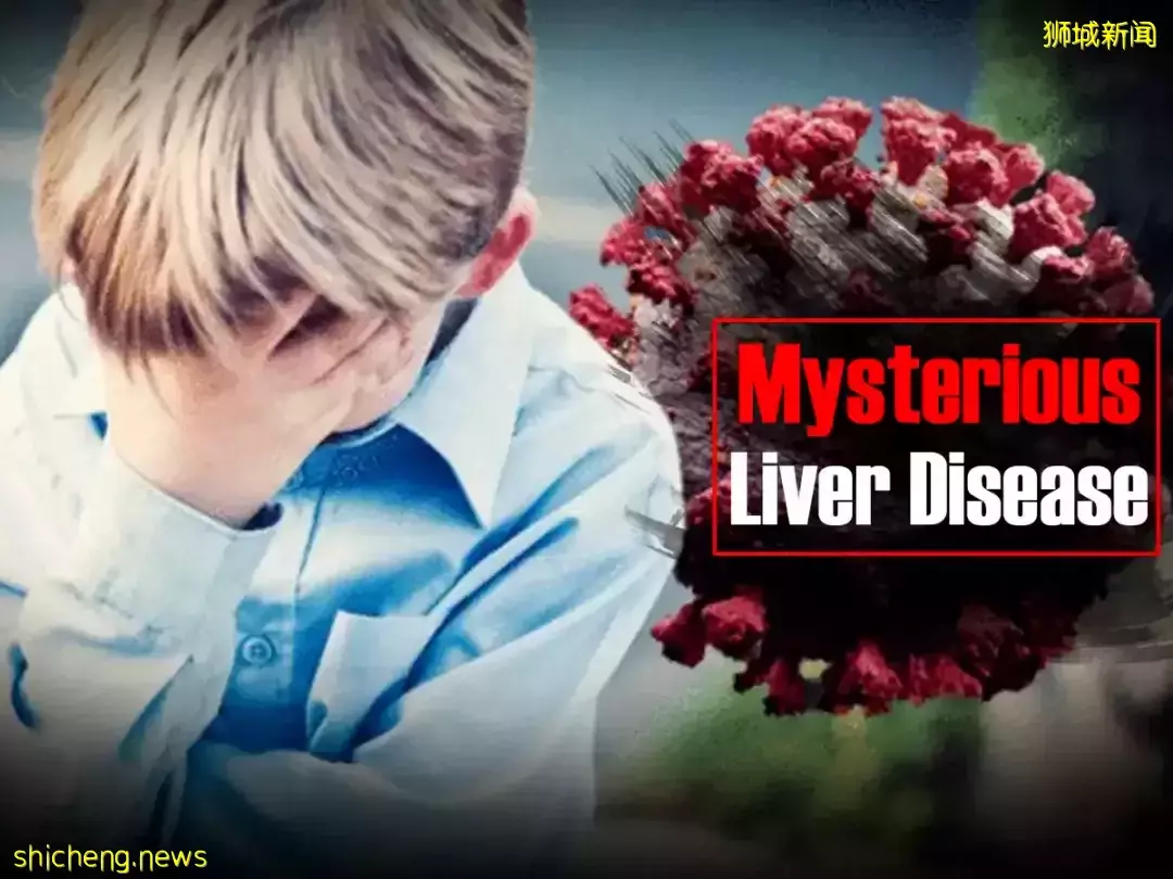 新加坡出现三起不明儿童急性肝炎病例,主要影响10岁以下孩童