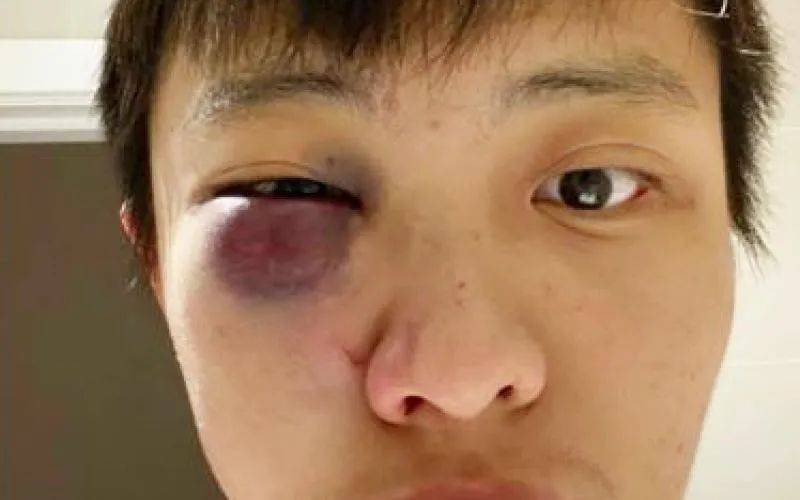 新加坡護照全球第二！亞裔在歐美頻頻遇襲，更多人要來新加坡了