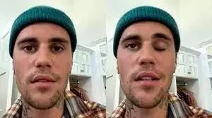 新加坡再發現一種後遺症！口齒不清、閉眼困難！3天後，一波新政出爐備戰"第5波"