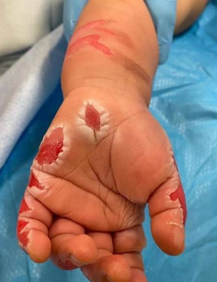 不想做女佣请你离开但是别选择伤 害！！新加坡再现非人女佣