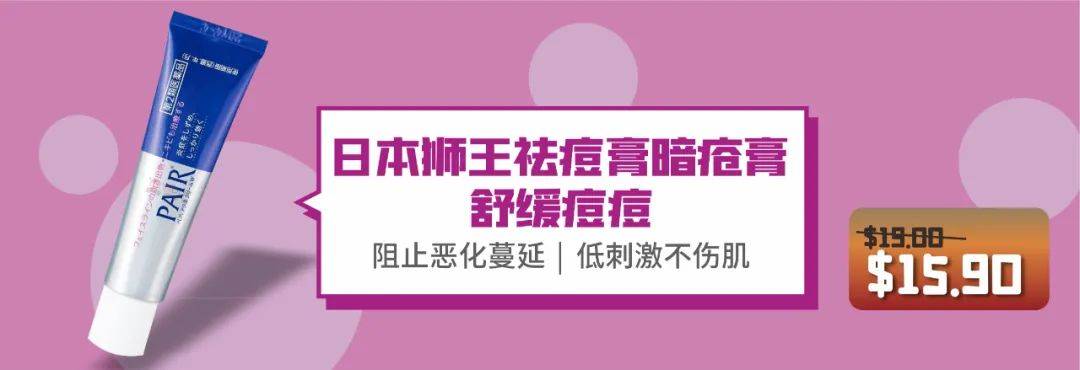 今年過年回國太難!新加坡10個必買好物備起來