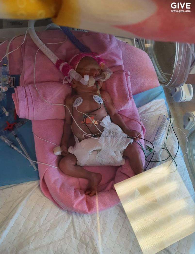 因誕下早産兒,這對馬來西亞夫婦在新加坡傾家蕩産