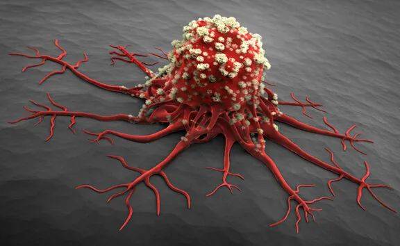 獅城財富通 癌症保險介紹