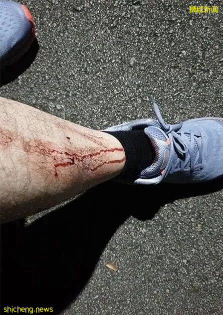 小心!有人在新加坡濱海灣花園徒步,被2米蟒蛇咬傷