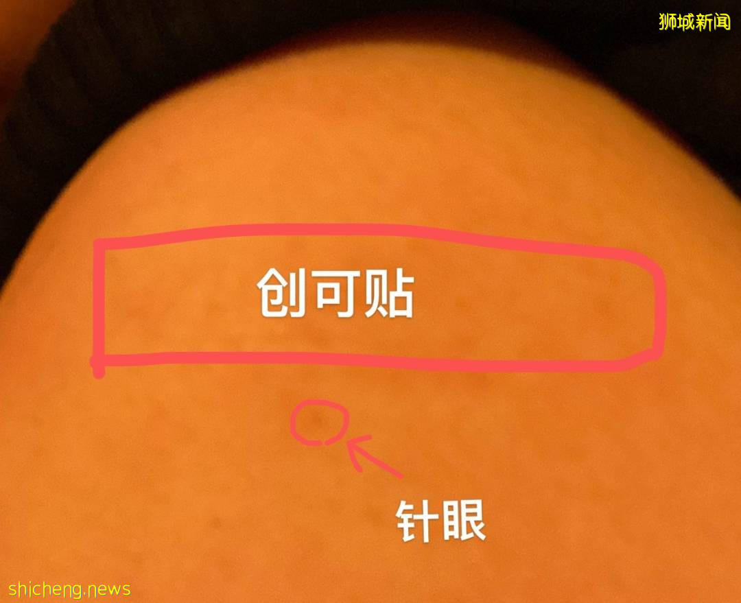 大意了！在新加坡打完科興沒聽醫生的，我後悔死了