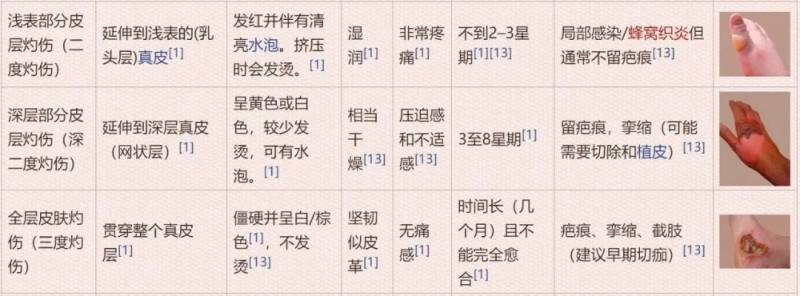 最毒婦人心?新加坡女人因爲吃醋,一杯熱水潑到了男友那裏