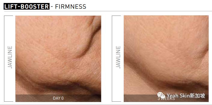 三重福利！贵妇级院线抗衰护理——法国FILLMED来新加坡啦