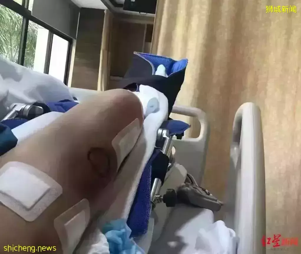 新加坡医生回应!中国女子控诉花50万做“断骨增高”手术失败