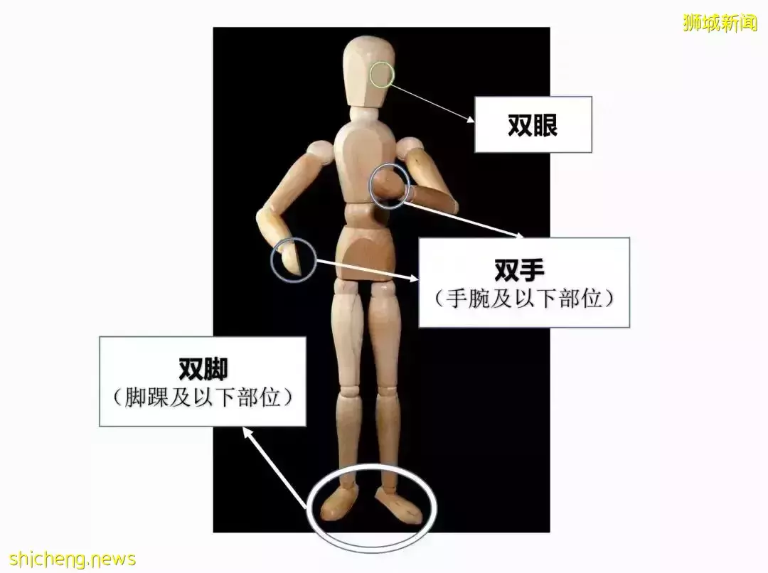 在新加坡为什么要买人寿保险