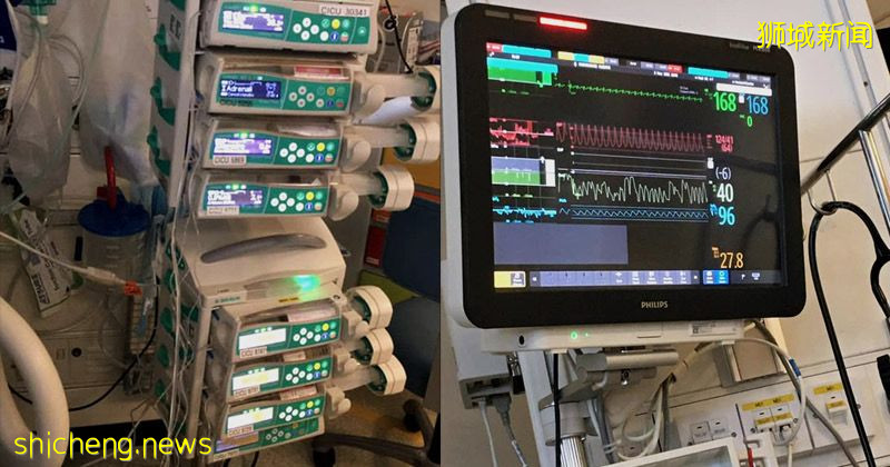 4歲確診童患MIS一C 身體多處插管 家人門外聽他哭嚎