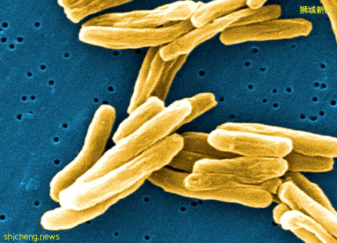 這種超級病菌比新冠還可怕，每年新加坡有8000多人感染