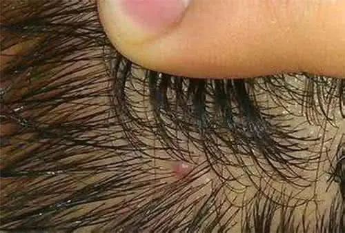 在新加坡潮热天气里疯狂掉发!如何科学送走大油头?