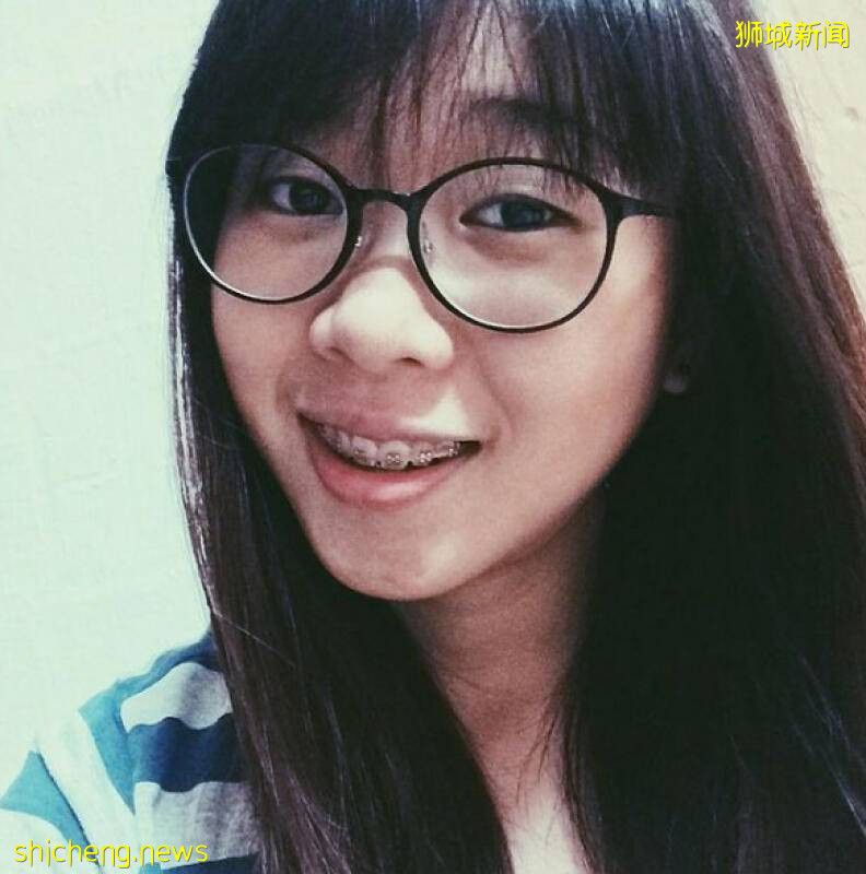 19岁女患斑秃症 毛发近掉光　