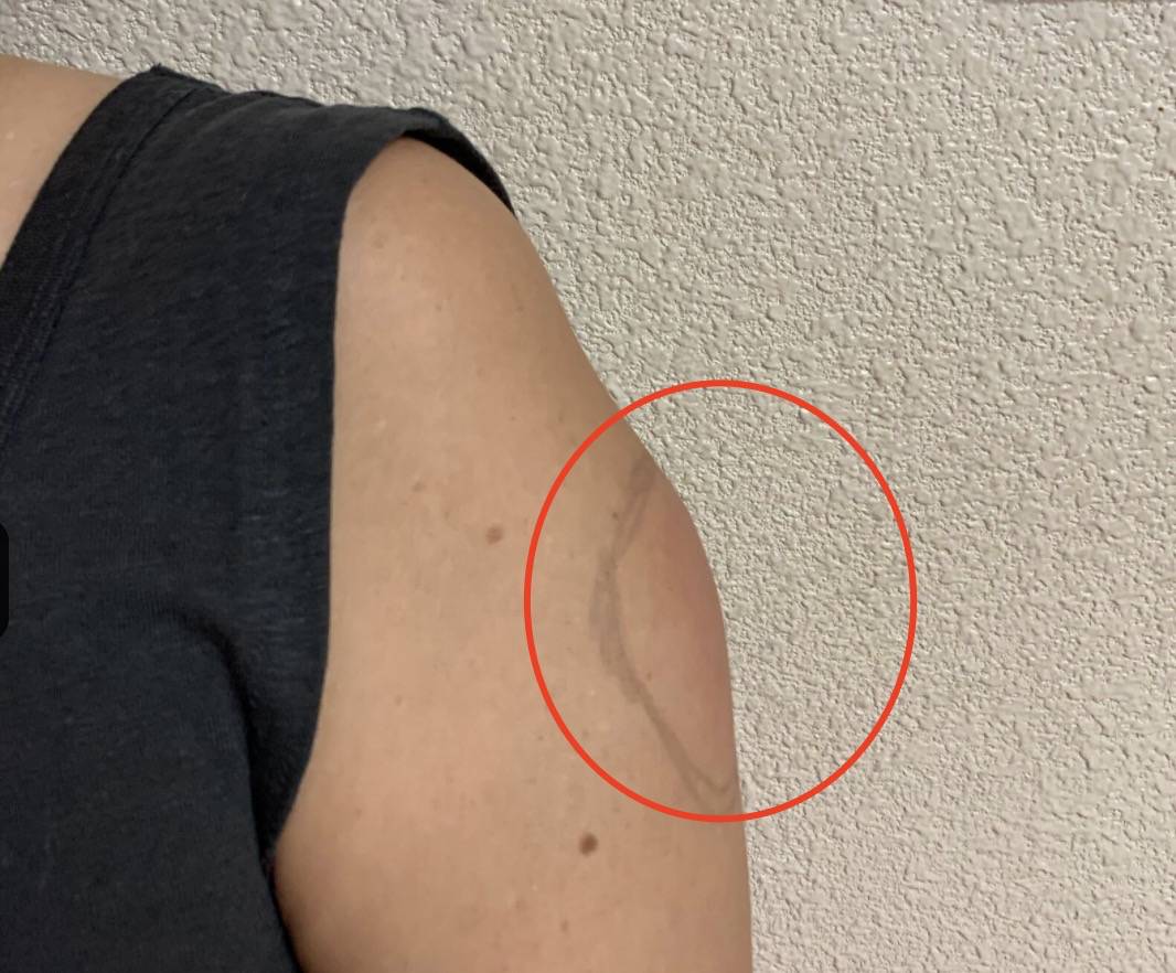 新加坡批准莫德納疫苗!深扒副作用:肌肉腫大、發燒39.4度