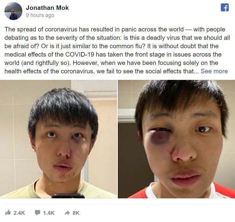 最新进展！新加坡留学生在海外被围殴致骨折，嫌疑人照片曝光