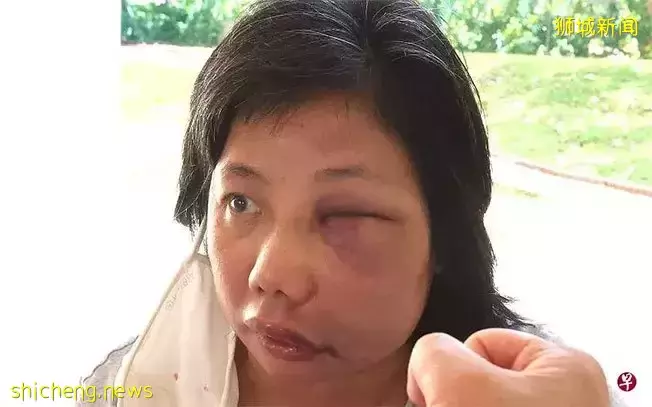 看你往哪逃!男送餐员暴打女同行 逃4天落网面控