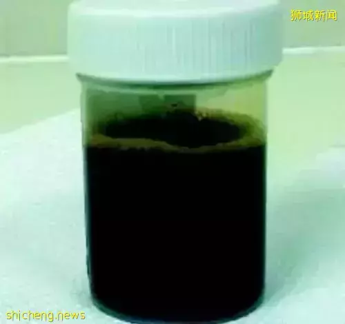 他,感染新冠后,被抽出一升黑色积液!新加坡医院开始增加床位