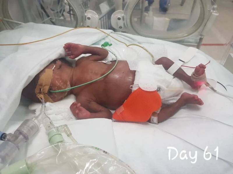 新加坡最輕早産兒僅345克，花了20多萬新幣才救活！新加坡看病到底有多貴