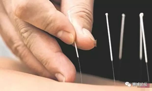 新加坡“装修工”摇身一变，成“拔罐高手”？！病人惨被手术…