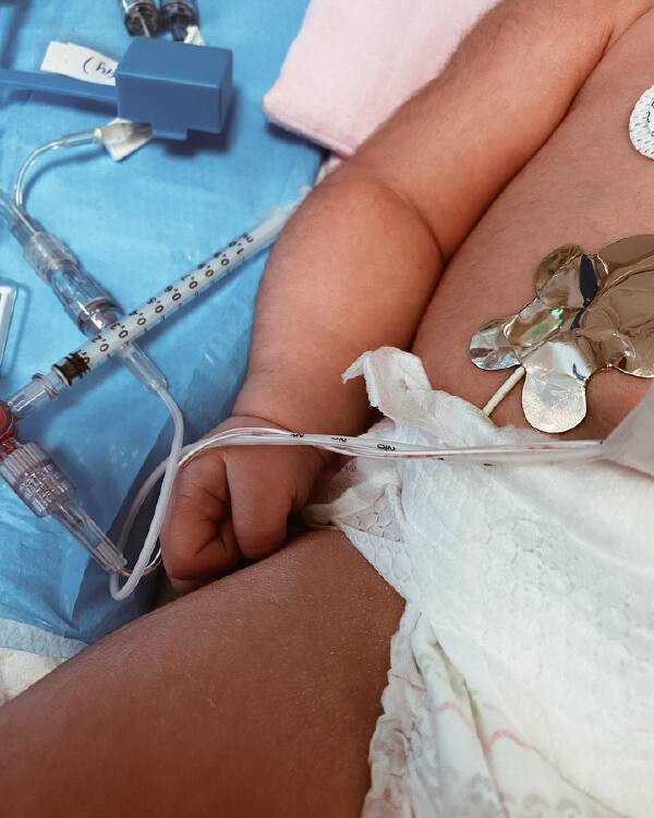 早产女婴一度心跳停止 母亲八天后终能将她拥入怀