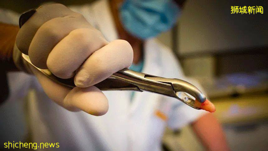 5歲女童拔牙後腦死亡!你還敢隨便在新加坡給孩子拔牙嗎