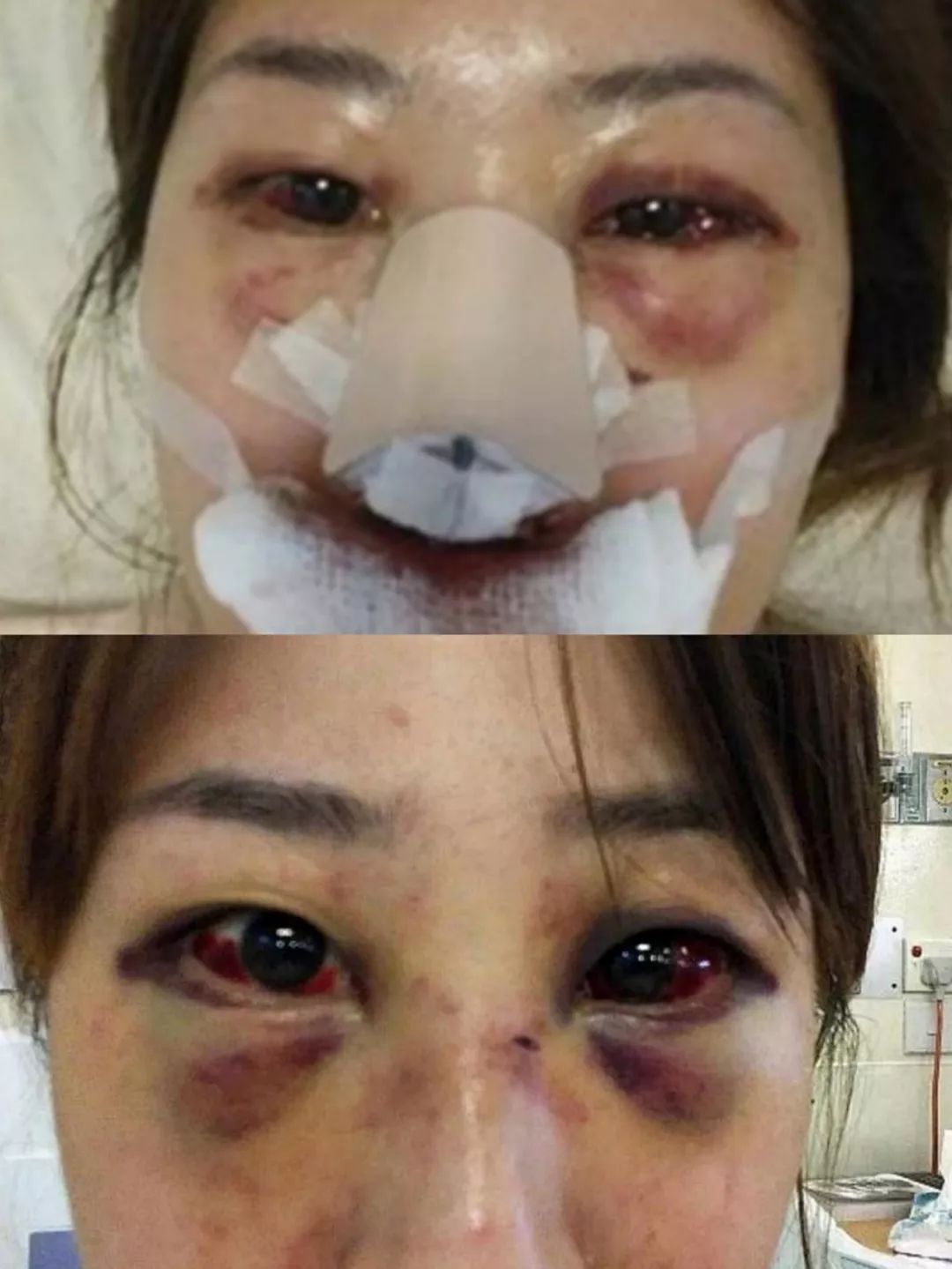 因为上床拒绝再来一次,新加坡医生将女友打成重伤住院!