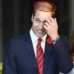 獅城這些“禿”如其來的煩惱,讓它幫你解決