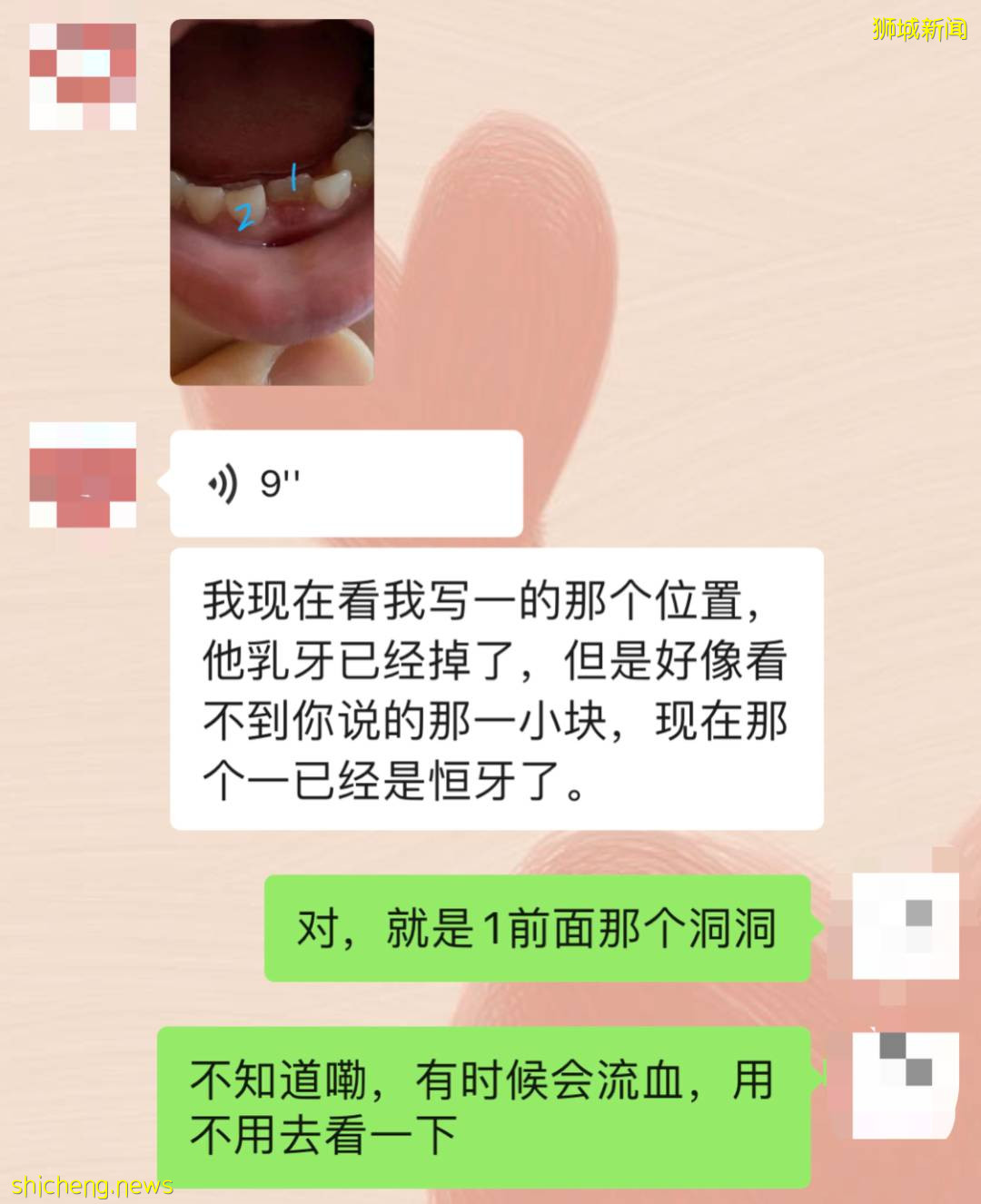 5歲女童拔牙後腦死亡!你還敢隨便在新加坡給孩子拔牙嗎