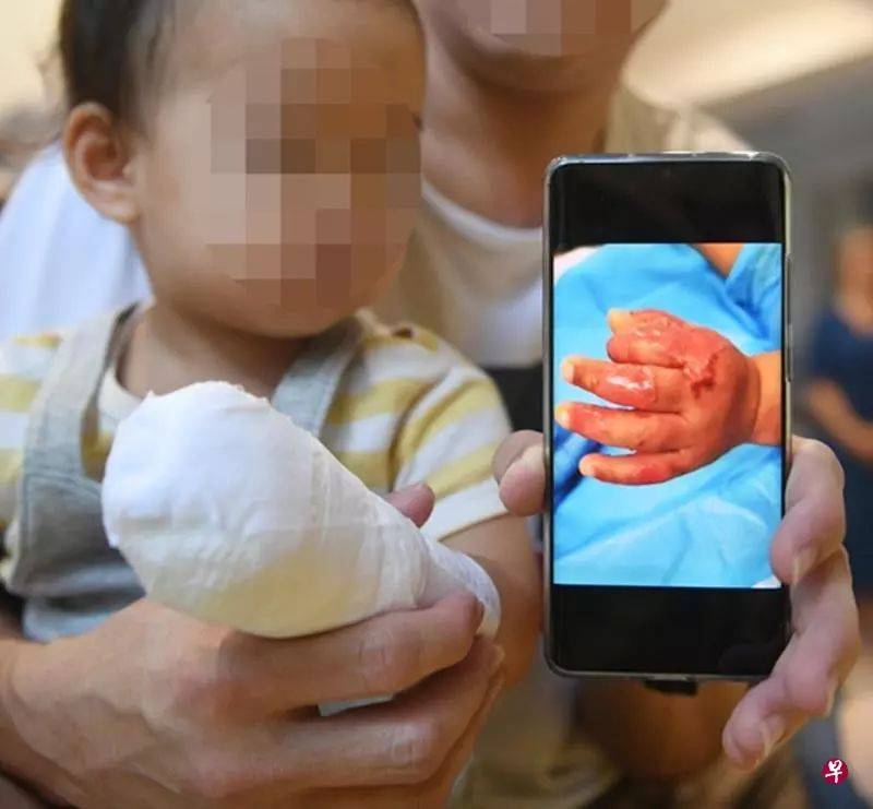 新加坡17個月寶寶手被女傭放鍋裏煮,皮開肉綻!判坐牢14個月