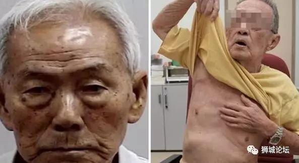 新加坡的老人都怎么了，89岁安哥居然因小事在老人院挥刀砍人？！