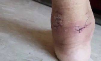 小心!有人在新加坡濱海灣花園徒步,被2米蟒蛇咬傷