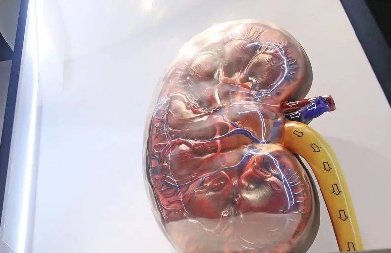 新加坡洗肾为何这么多？这几种食物吃得多，肾会出大问题