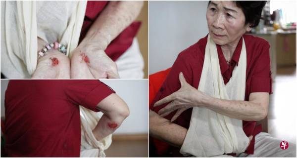 遭凸起路面绊倒 阿嫲肋骨裂手骨折