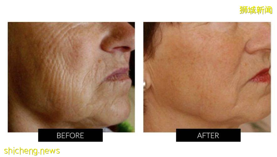 Yamen、TriPollar、Foreo給皇後粉獨家折扣！低至35折！新加坡疫情這麽嚴重我們還是待家裏做個美容吧