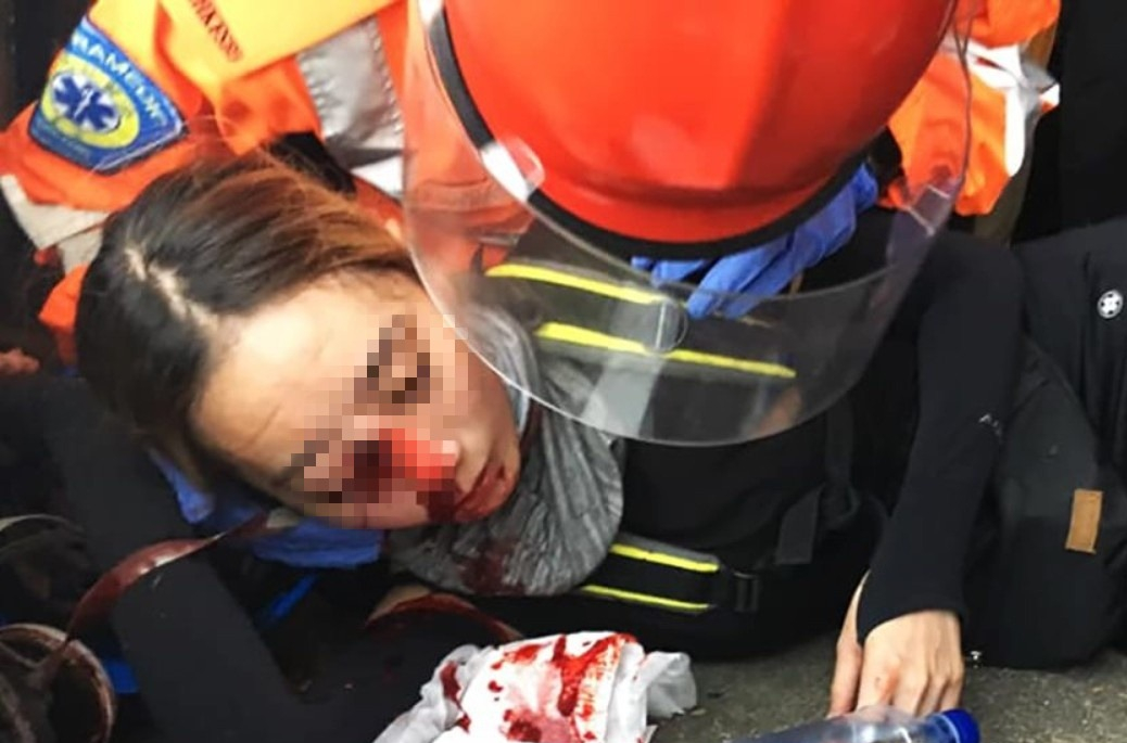 20190814 受傷女子 3.jpg