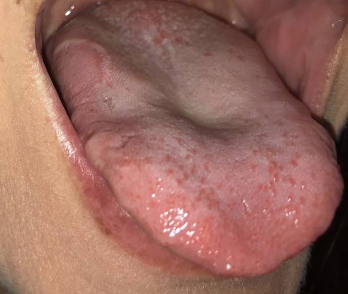 新加坡机场员工紧急检测!曝感染新冠后可能会出现这14种症状