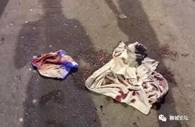 无！语！新加坡学生在新山被撞飞，当地医院居然做了这两件事！