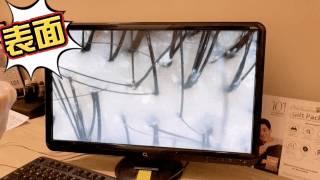 脫發救星來了！不到一折價格體驗新加坡最頂尖的防脫發服務，超級值