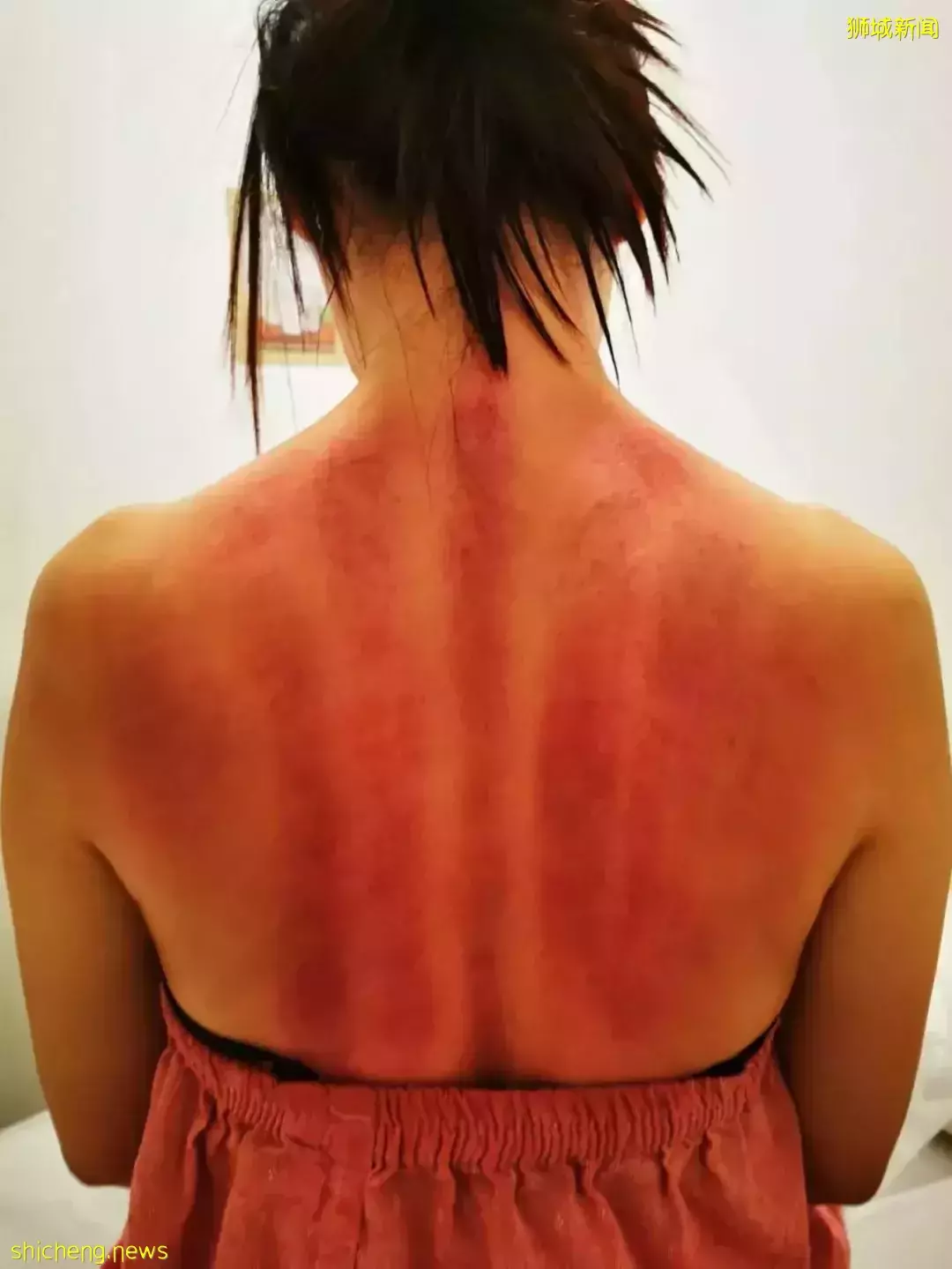 “急问!我家孩子新冠转阴后还是一直咳嗽,怎么办?”