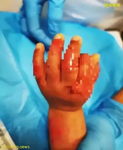 掌掴、捆綁、開水燙……新加坡虐童案達10年新高，這些惡魔都是誰