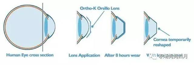 新加坡近視率全球第一！家長如何拯救孩子的眼睛