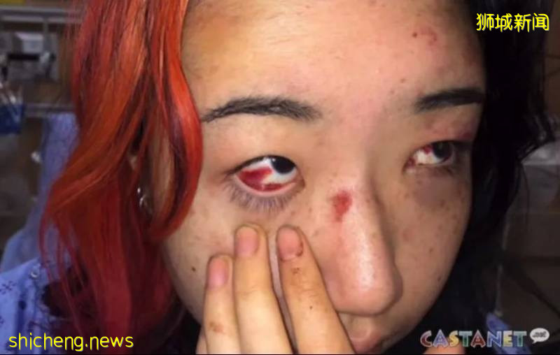 愤怒!华人女生在国外被警察踩头、扯头发和拖拽!亚裔也被歧视